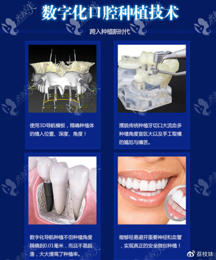 登腾种植牙，重塑口腔健康的现代奇迹