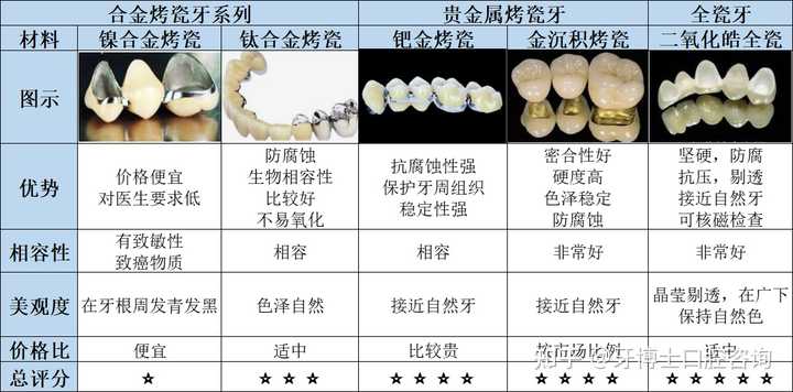 钴铬烤瓷牙价格表，全面解析与选择指南