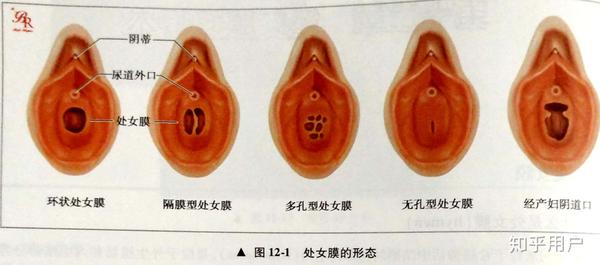 女人私密整形的选择与对比，一次深思熟虑的旅程