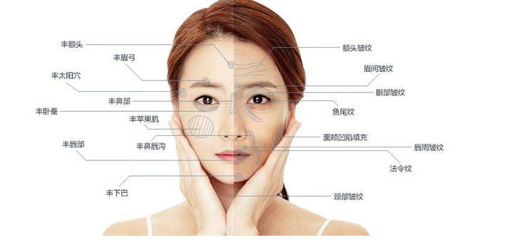 自体脂肪填充面颊，价格、过程与效果解析