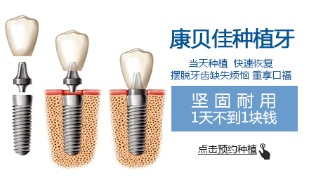 种植一颗牙，价格、因素与价值考量